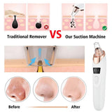 5-in-1 Blackhead Removal Device