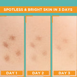 Garnier Vitamin C Brightening Serum – 30ml