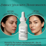 The Ordinary Niacinamide 10% + Zinc 1% Serum – 30ml