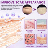 TIMILK Advanced Scarvanisher Gel