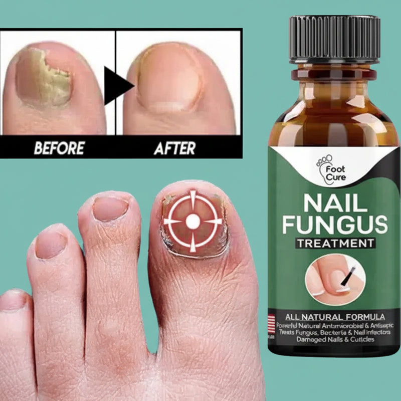 Anti-Fungal Nail Serum